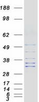 Human FAM82B Protein (Recombinant Myc-DDK (Flag))