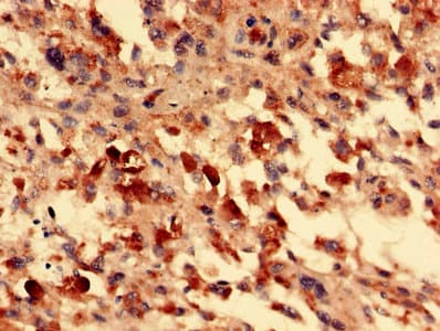 Polyclonal Rabbit anti-Human FOXR2 Antibody (IHC, WB)