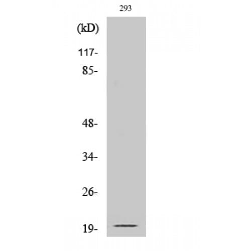 Polyclonal Rabbit anti-Human EFNA2 / Ephrin A2 Antibody (110-190 aa, C-terminal, WB)