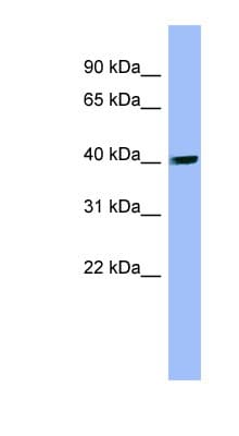 PIP4K2A / PIPK Antibody (aa107-156)