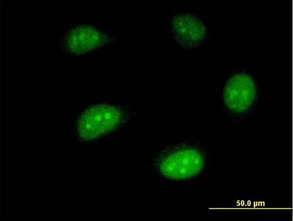 HEM45 / ISG20 Antibody (clone 1B2-3C9)