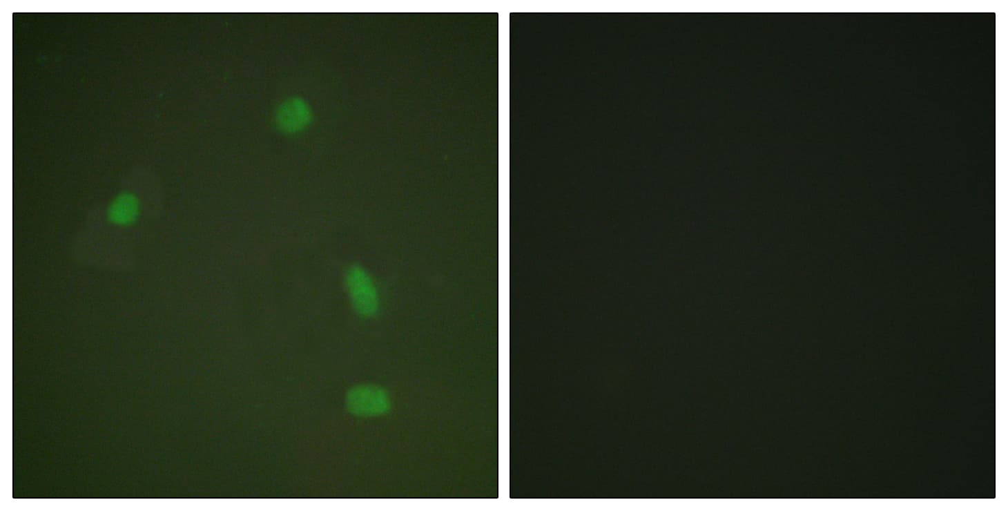 PR / Progesterone Receptor Antibody (phospho-Ser400)