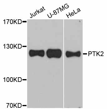 FAK / Focal Adhesion Kinase Antibody