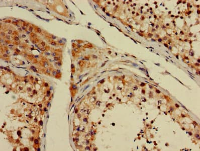 GSTT1 Antibody