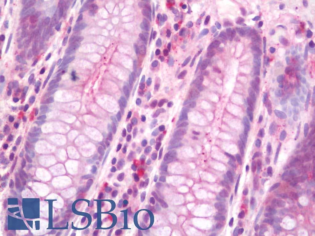 IHC-plus™ Polyclonal Rabbit anti-Human HLA-G Antibody (aa45-94, IHC, WB)