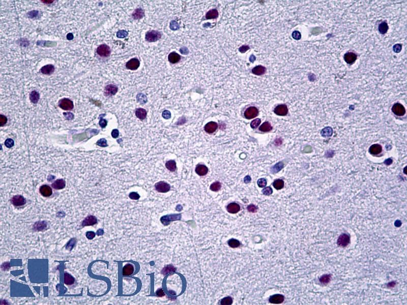 IHC-plus™ UBR5 Antibody (aa600-650)