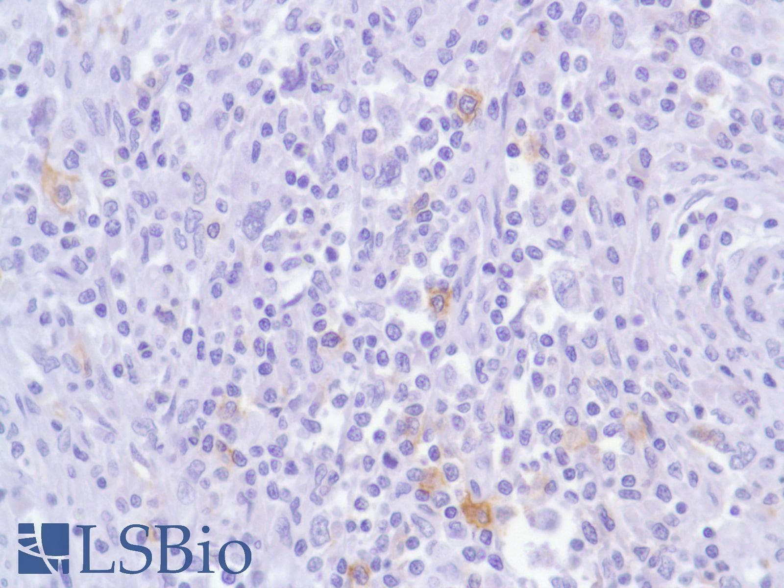 ICOS / CD278 Antibody (C-Terminus, clone SP98)