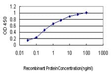 Rho Kinase / ROCK1 Antibody (clone 2E2)