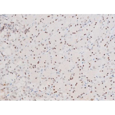 RELA / NFKB p65 Antibody (phospho-Ser281)