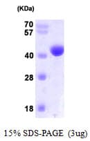 Human NANS Protein (Recombinant His)