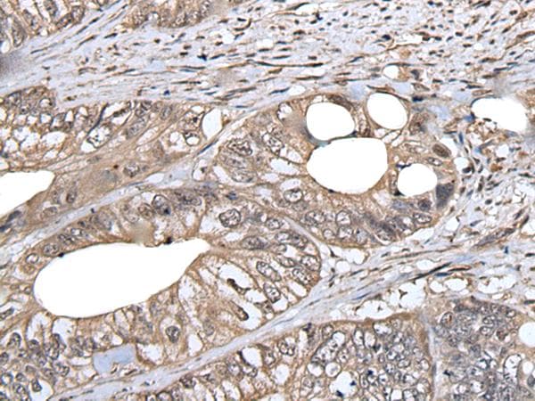 DLK1 / Pref-1 Antibody