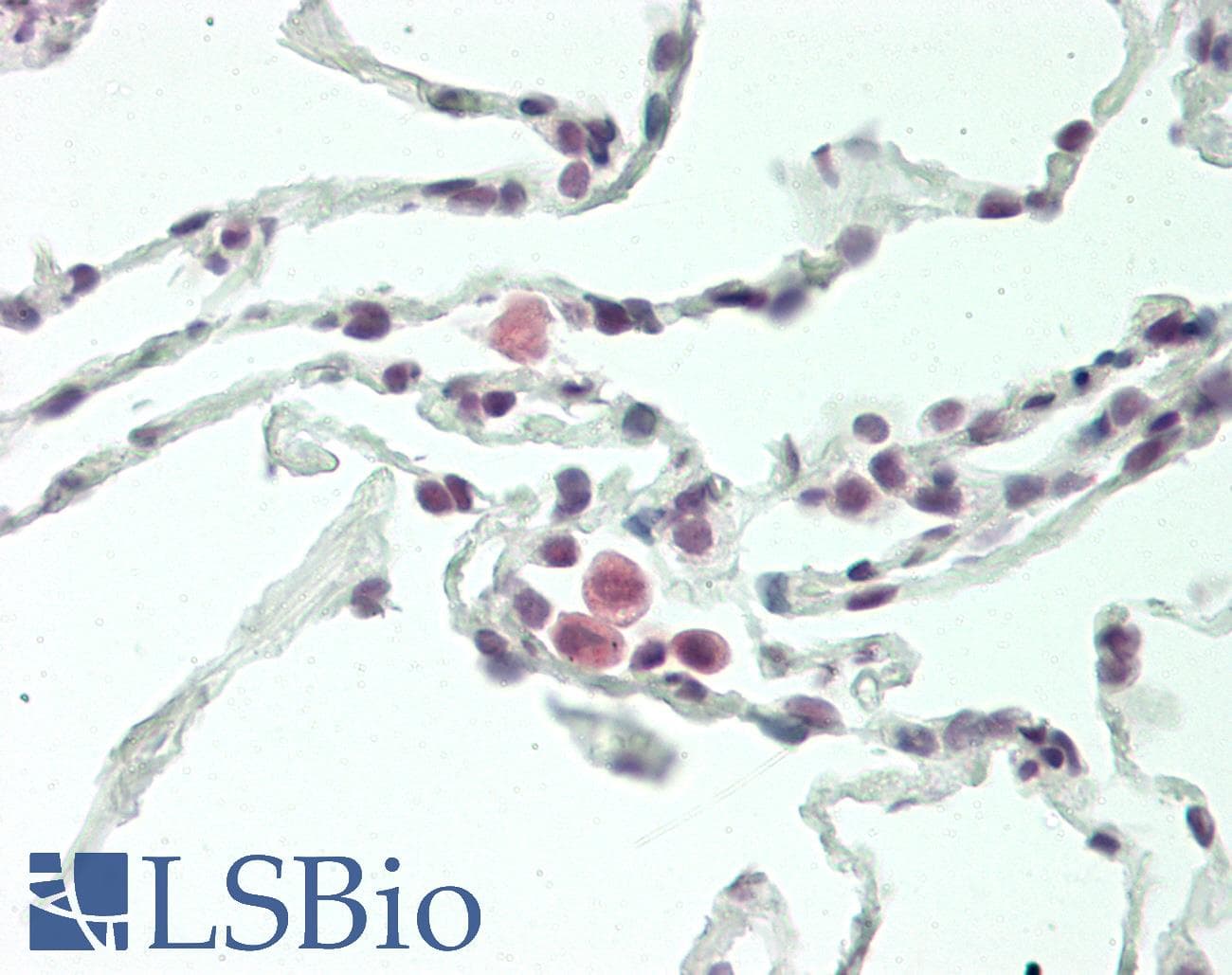 IHC-plus™ FCAR / CD89 Antibody (aa58-84)