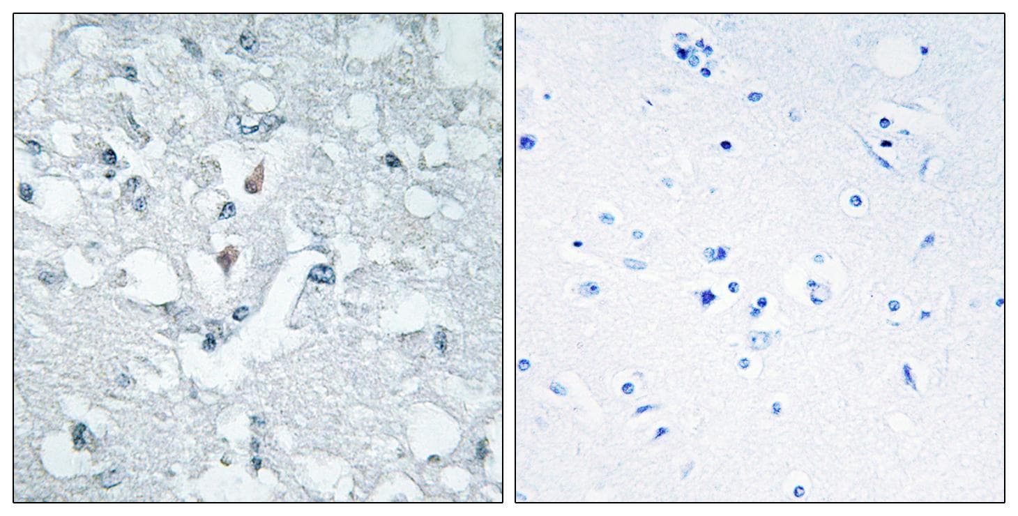 GLYCTK / Glycerate Kinase Antibody