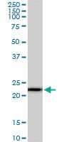 Monoclonal Mouse anti-Human RPS5 / Ribosomal Protein S5 Antibody (clone 3G3, WB)