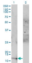ACYP1 Antibody (clone 1B2-3A2)