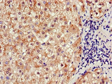 SLCO1B3 / OATP8 Antibody