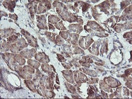 RAB21 Antibody (clone OTI4A6)
