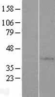 AP4S1 Protein (Over-Expression Lysate Myc-DDK (Flag))