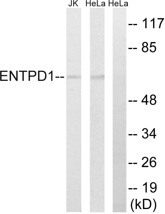 CD39 Antibody