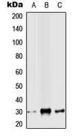 Polyclonal Rabbit anti-Human SNAI2 / SLUG Antibody (N-Terminus, WB)