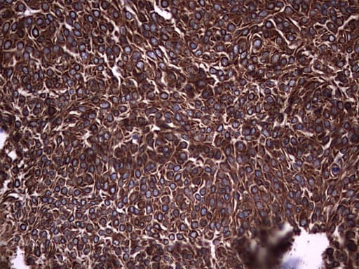 IHC-plus™ Acidic Cytokeratin Antibody (clone 1D10)