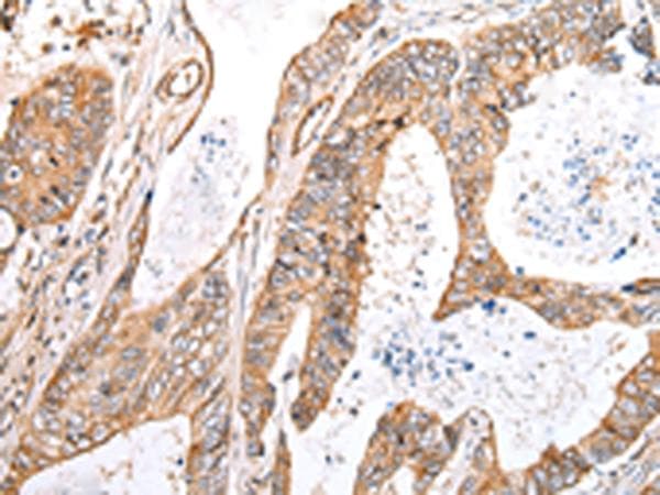 KCTD16 Antibody