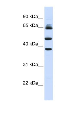 Polyclonal Rabbit anti-Human FBXL3 Antibody (aa144-193, WB)