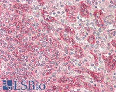 COL4A1 / Collagen IV Alpha1 Antibody (Biotin)