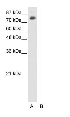 Polyclonal Rabbit anti-Human TSC22D2 Antibody (HRP, N-Terminus, IHC, WB)