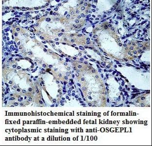 Polyclonal Rabbit anti-Human OSGEPL1 Antibody (aa121-387, IHC, WB)