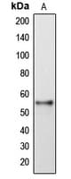 IHC-plus™ Polyclonal Rabbit anti-Human DFNA5 Antibody (aa231-270, IHC, WB)