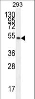 IHC-plus™ Polyclonal Rabbit anti-Human IGSF5 / JAM4 Antibody (aa1-30, IHC, WB)