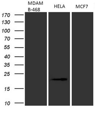 p16INK4a / CDKN2A Antibody (clone OTI7B10)