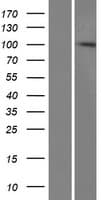 Human PARP13 / ZC3HAV1 Protein (Over-Expression Lysate Myc-DDK (Flag))