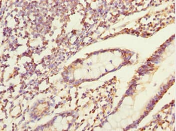 ERO1A / ERO1L Antibody