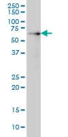 AKT1 Antibody (clone 2H1)
