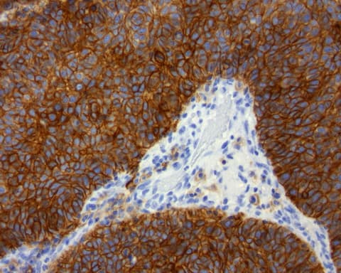 CD274 / B7-H1 / PD-L1 Antibody (C-Terminus, clone OR-5E3)