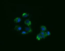 ACAA2 Antibody (clone OTI1B1)