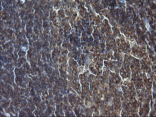 FNDC8 Antibody (clone OTI1C10)