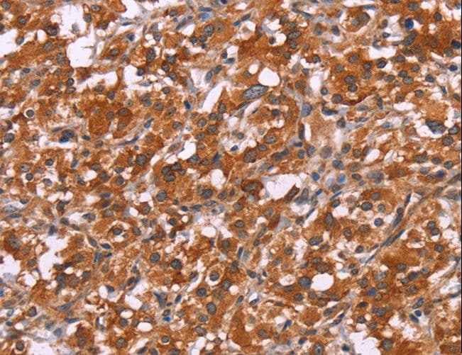 HSPB6 / HSP20 Antibody