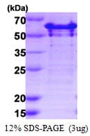 Human G3BP2 Protein (Recombinant His)