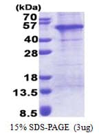 Human AP1AR Protein (Recombinant His)