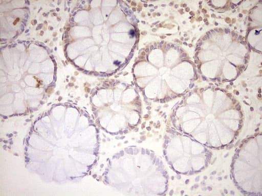 LPIN1 / Lipin 1 Antibody (aa1-274, clone OTI4C11)