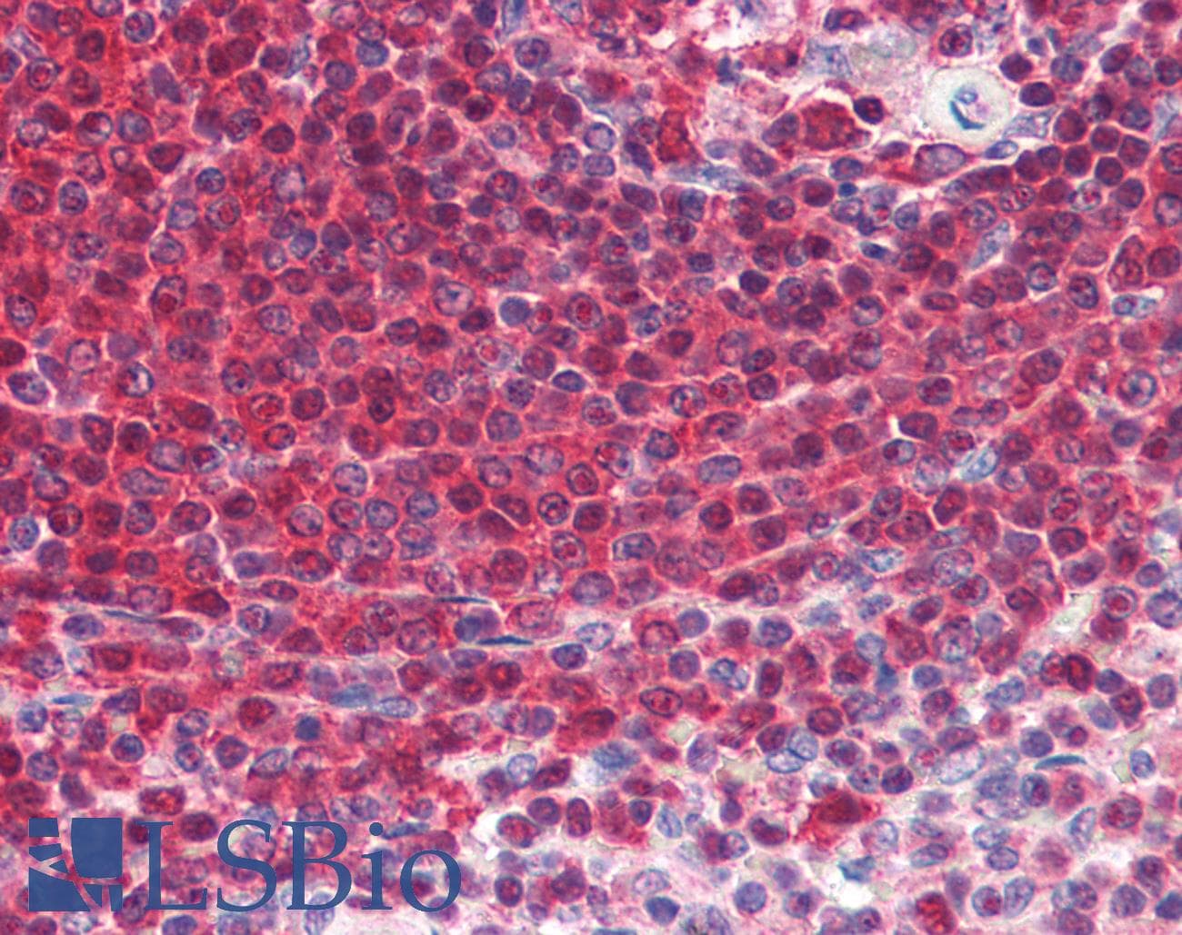 IHC-plus™ Monoclonal Mouse anti-Rat GRB2 Antibody (IHC, WB)