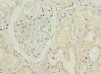 PTAFR / PAF Receptor Antibody