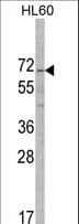 ALKBH8 Antibody (aa494-523)
