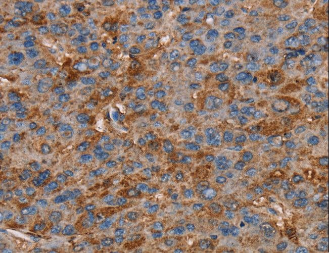 Polyclonal Rabbit anti-Human NEDD4L / NEDD4-2 Antibody (IHC)