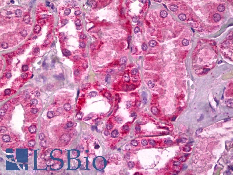 IHC-plus™ Polyclonal Rabbit anti-Human 15-PGDH / HPGD Antibody (IHC, WB)