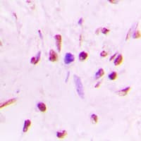 HSF1 Antibody (phospho-Ser303)