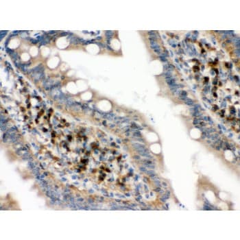 EIF4A2 Antibody (aa5-31)
